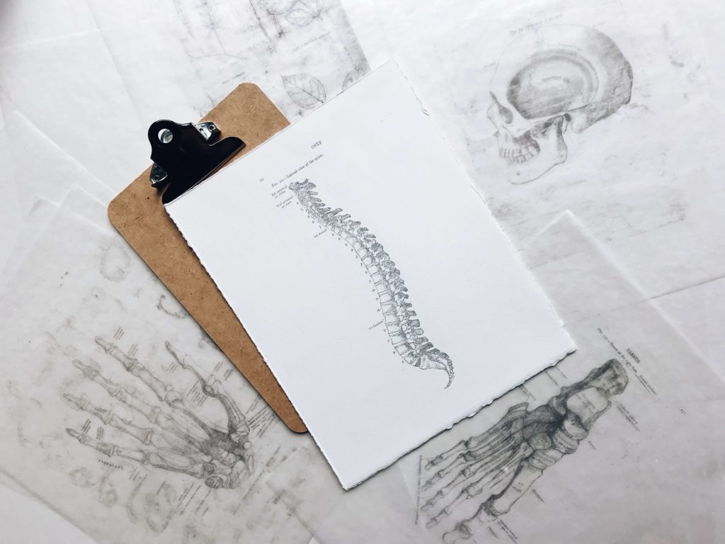 Drawing of the spine showing sciatica